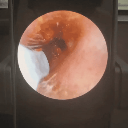 Palm 2.0 Slivor Nebulae HD Camera Ear Cleaner - PALM 2.0